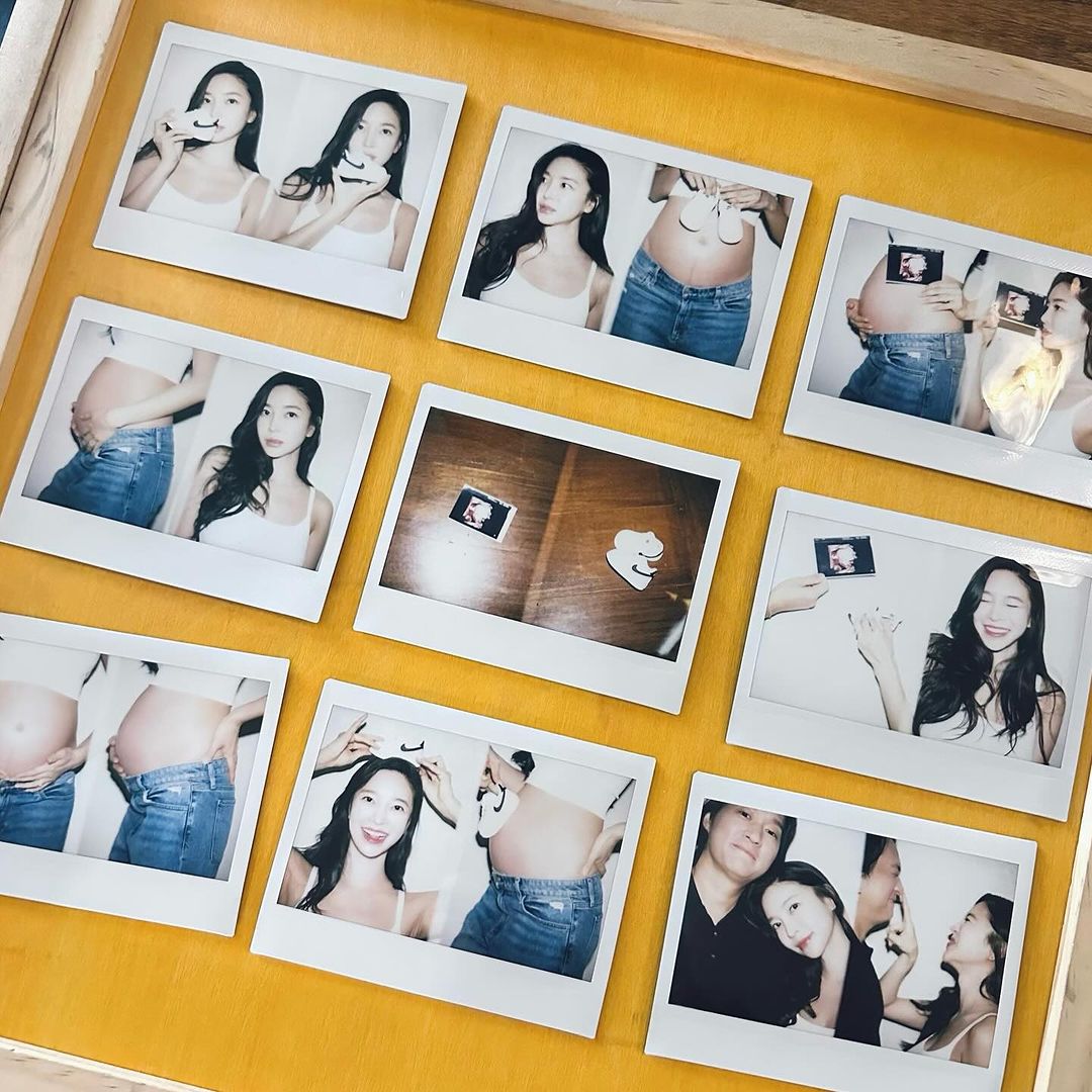 김윤지 이미지